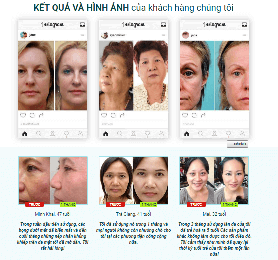 MỚI-Kem-innogialuron-có-tốt-không-Mua-ở-đâu-Giá-bao-nhiêu-15